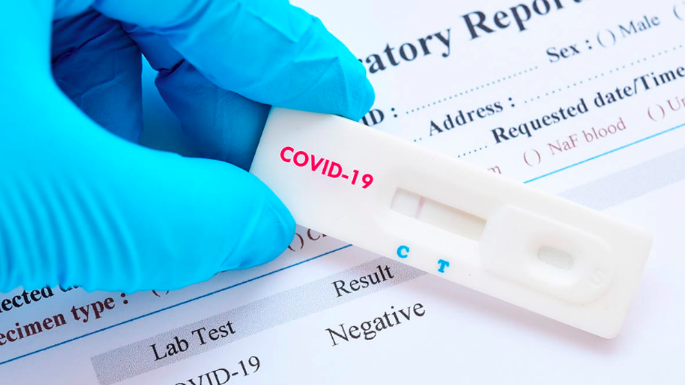 El Cest firma un convenio con los laboratorios González Santiago – EUROFINS LGS MEGALAB ANÁLISIS CLINICOS para hacer tests de Covid19 para nuestros Asociados, sus familiares y empleados.