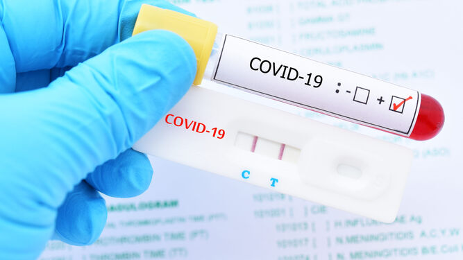 Nota de Prensa. El Cest valora de forma muy positiva, pero expectante, el decreto aprobado por el Gobierno de Canarias admitiendo los test de antígenos como prueba diagnóstica para el control sanitario de los visitantes extranjeros.